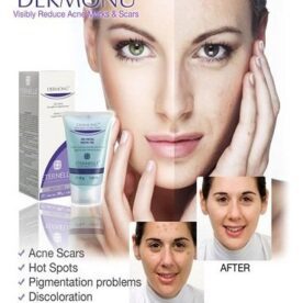 Dermonu Acne Removal Cream in Pakistan