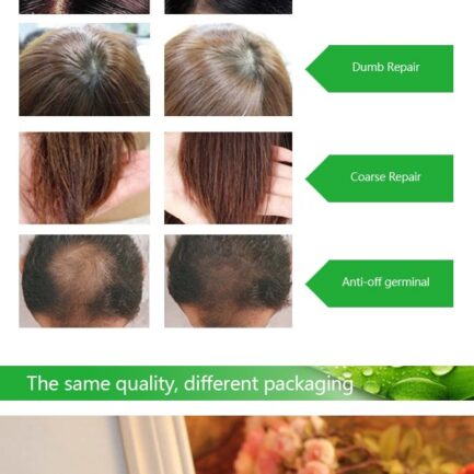 dexe hair shampoo anti hair loss 5