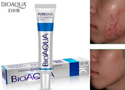 Bioaqua Anti Acne Scar Mark Removal Treatment Cream in Pakistan
