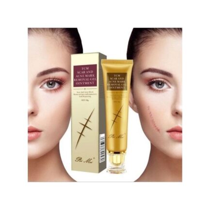 TCM SCAR ACNE MARK REMOVAL GEL CREAM 30G1