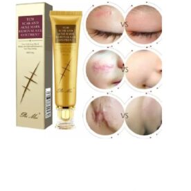 TCM SCAR & ACNE MARK REMOVAL GEL CREAM (30G)