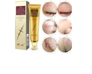 TCM SCAR & ACNE MARK REMOVAL GEL CREAM (30G)
